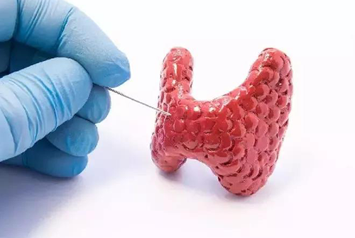 甲状腺疾。。。。。。。，，，包括甲状腺功效减退和甲状腺功效亢进，，，，，自古以来就是重复被医学研究职员研究的疾病