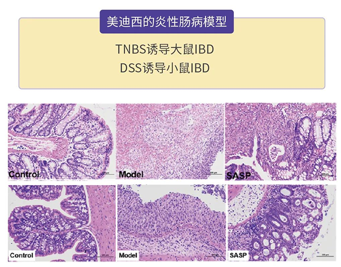 欧博ABG的炎性肠病模子.png